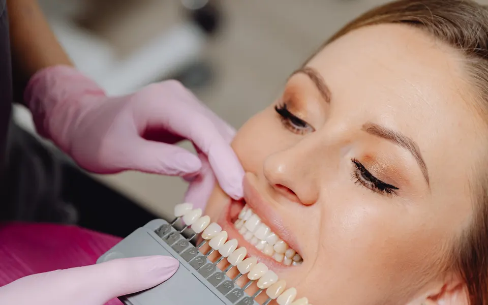 Guía de tonos dentales junto a la sonrisa de una paciente para elegir el color