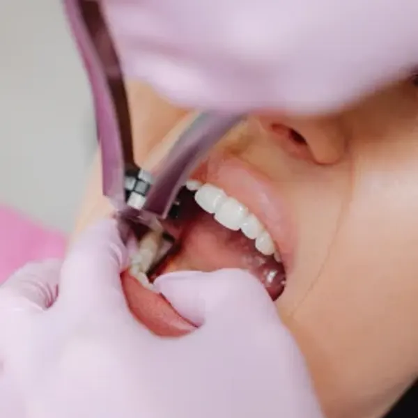 Procedimiento dental con instrumental esterilizado