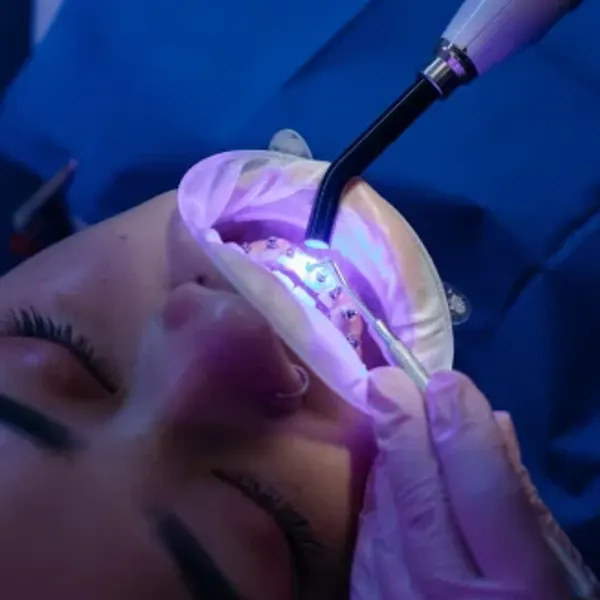 Paciente durante una limpieza dental en el consultorio
