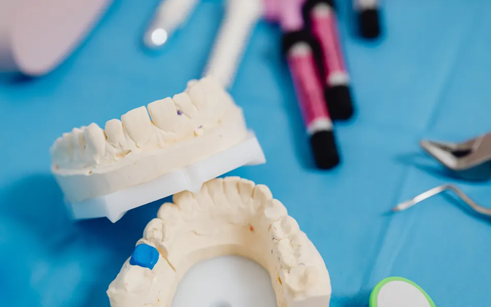Modelos de yeso de una dentadura con una prótesis en preparación