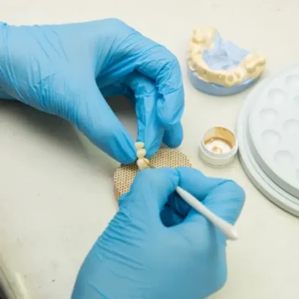 Trabajo de precisión sobre un molde dental
